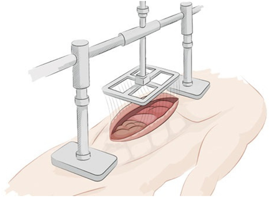 Fig. 2