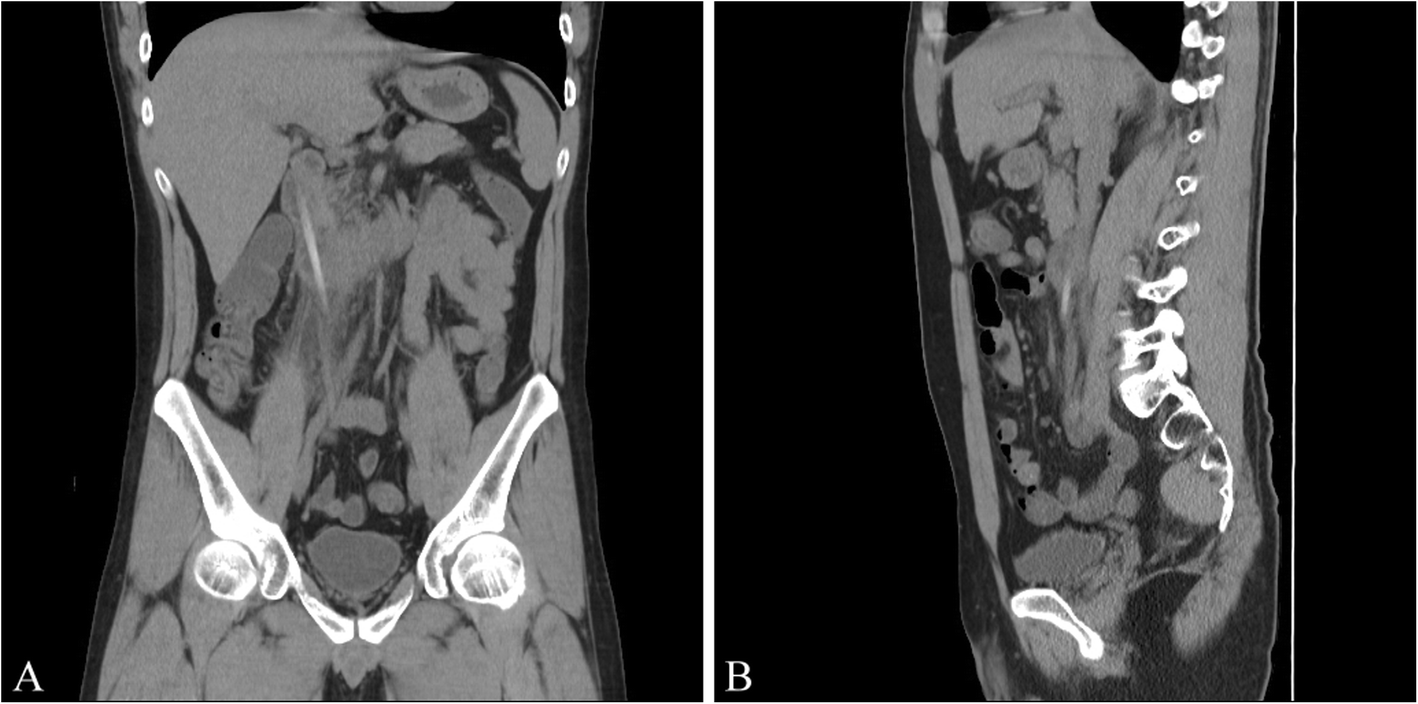 Fig. 1