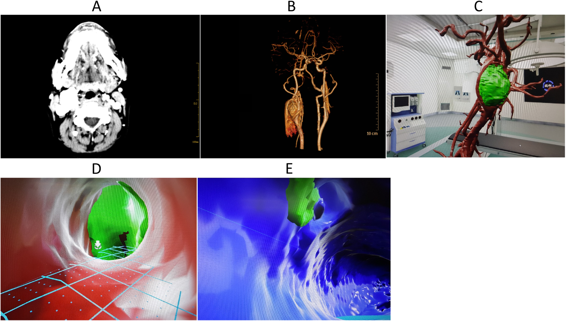 Fig. 2