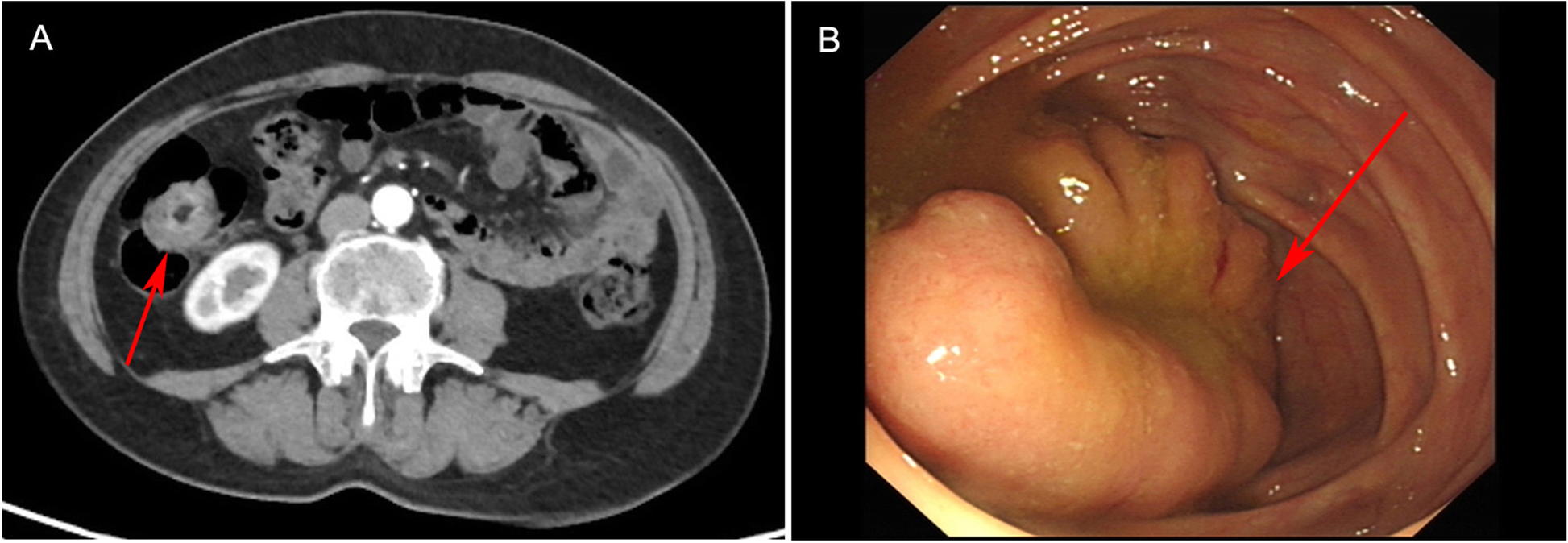 Fig. 1