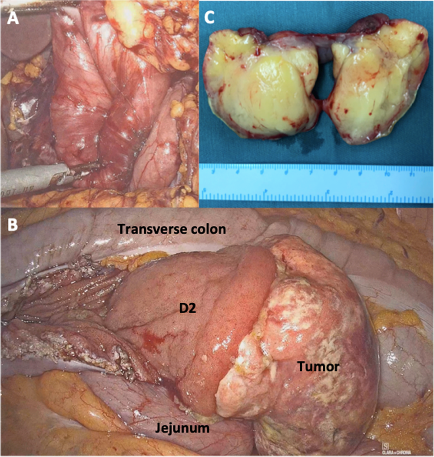 Fig. 2