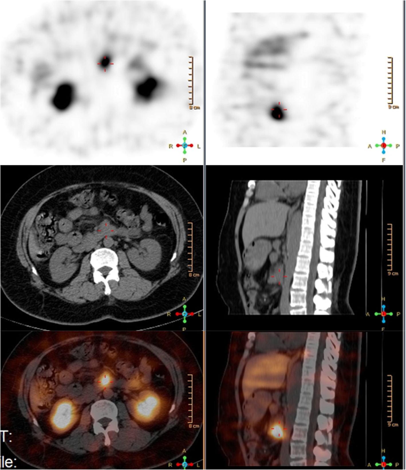 Fig. 3