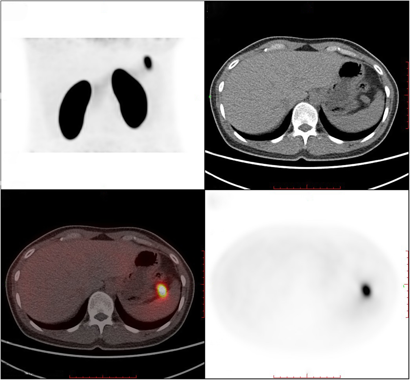 Fig. 6