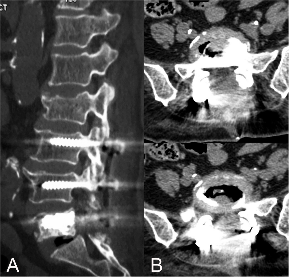 Fig. 4