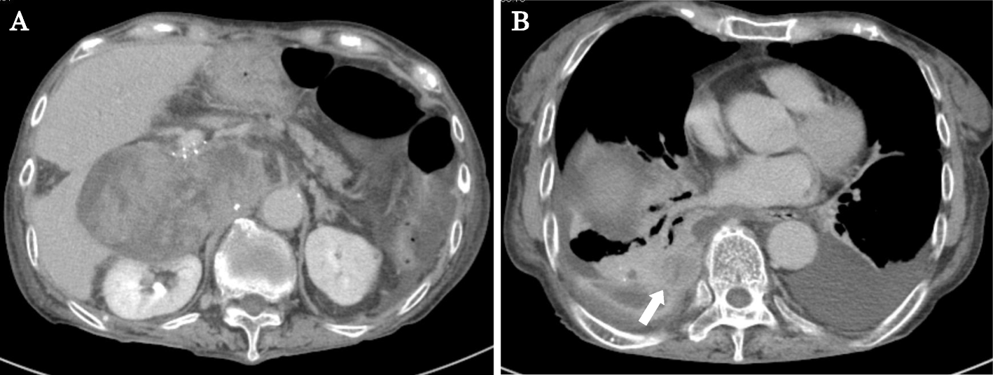 Fig. 5