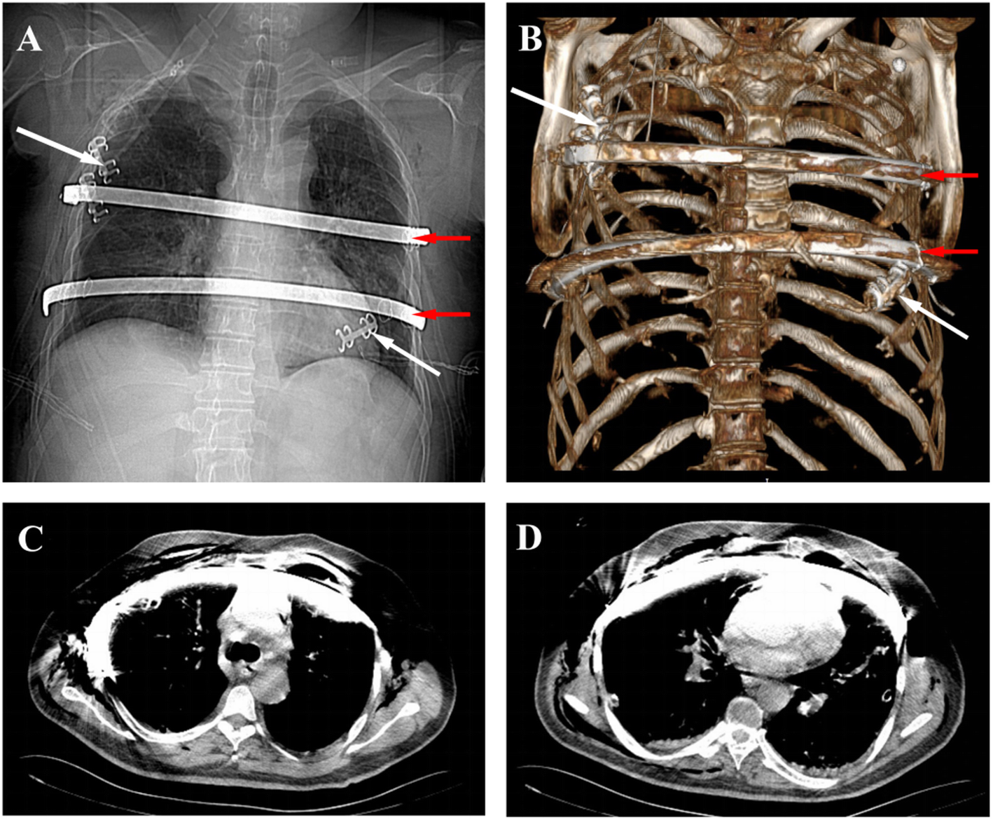 Fig. 2