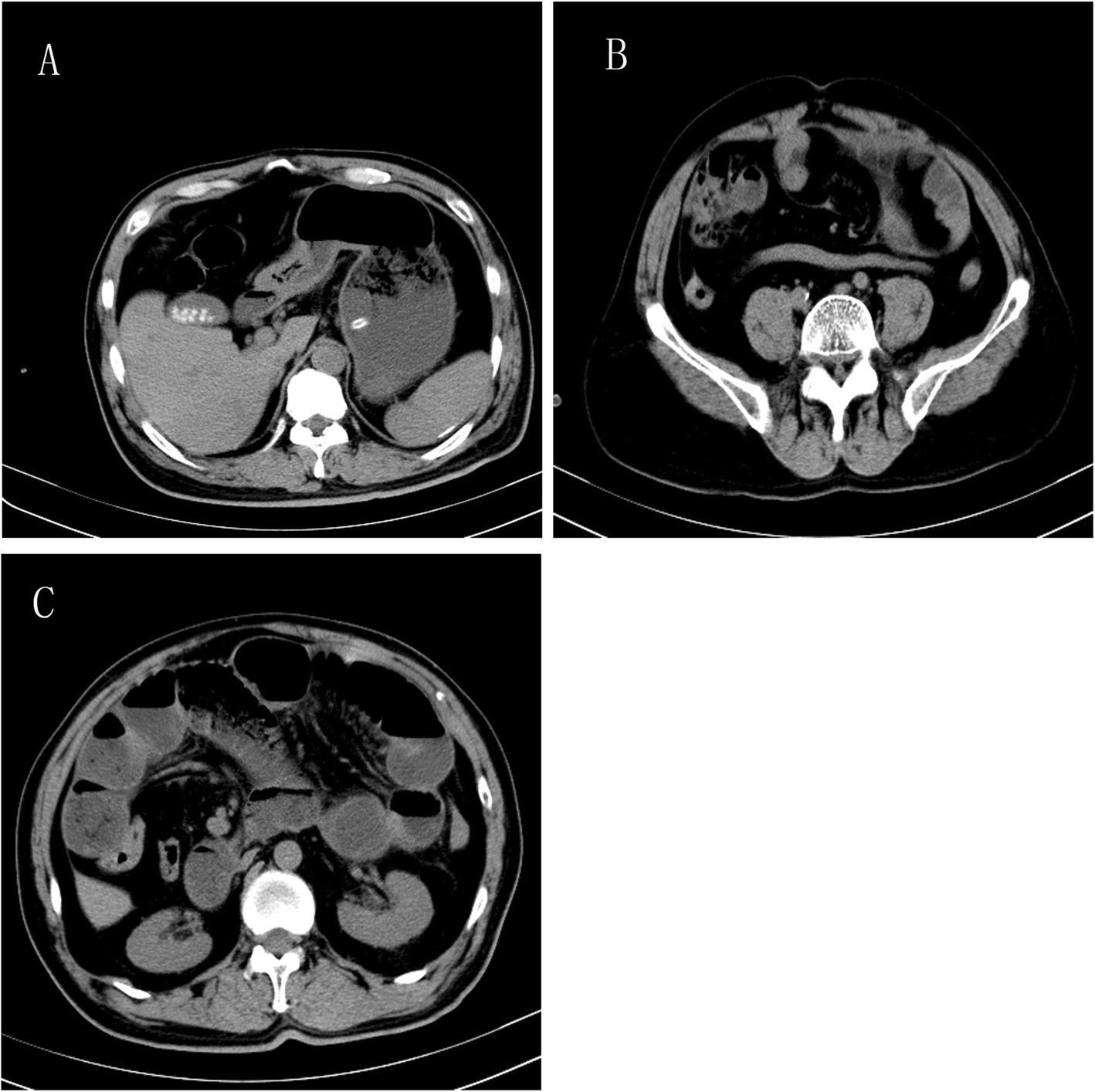 Fig. 2