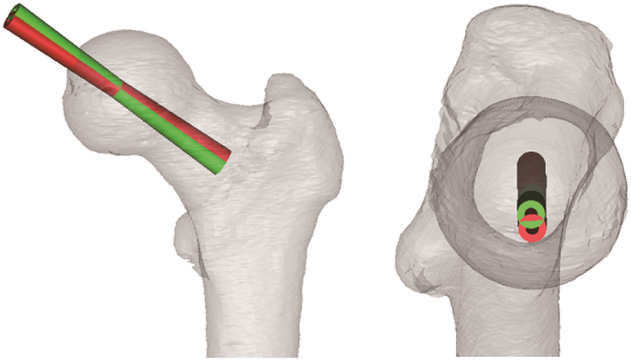 Fig. 2