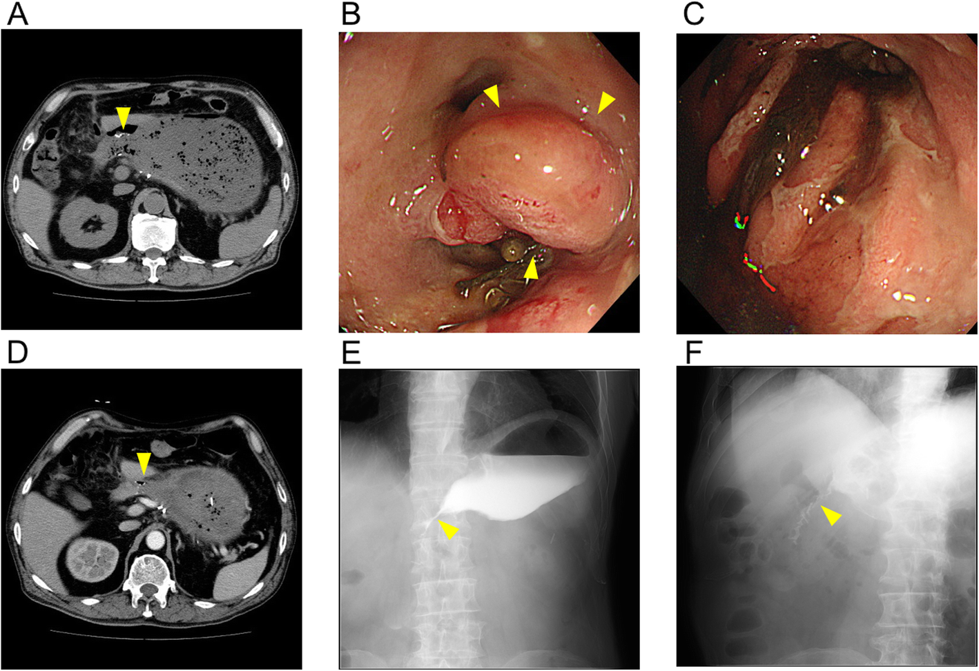 Fig. 1