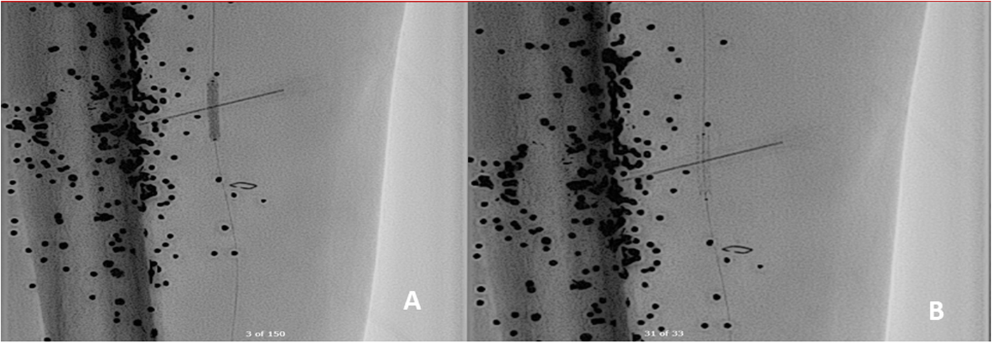 Fig. 4