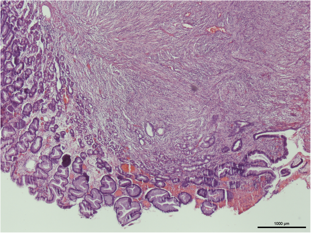 Fig. 10