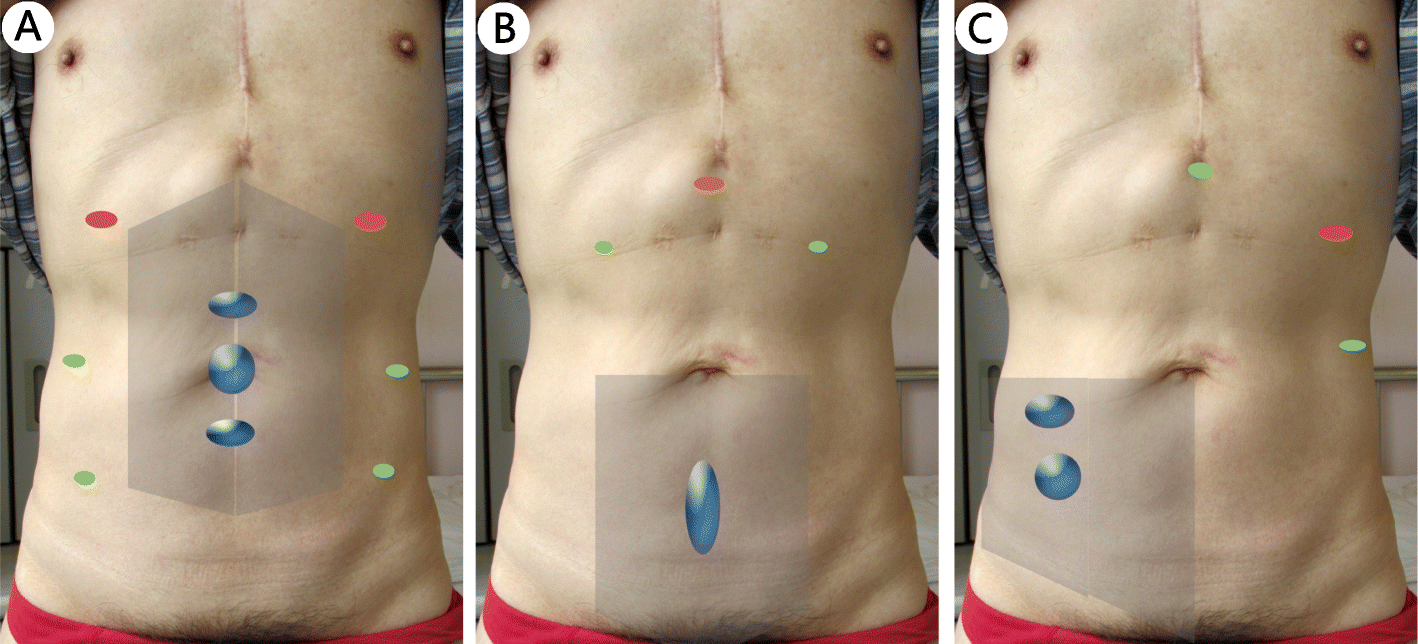 Fig. 2