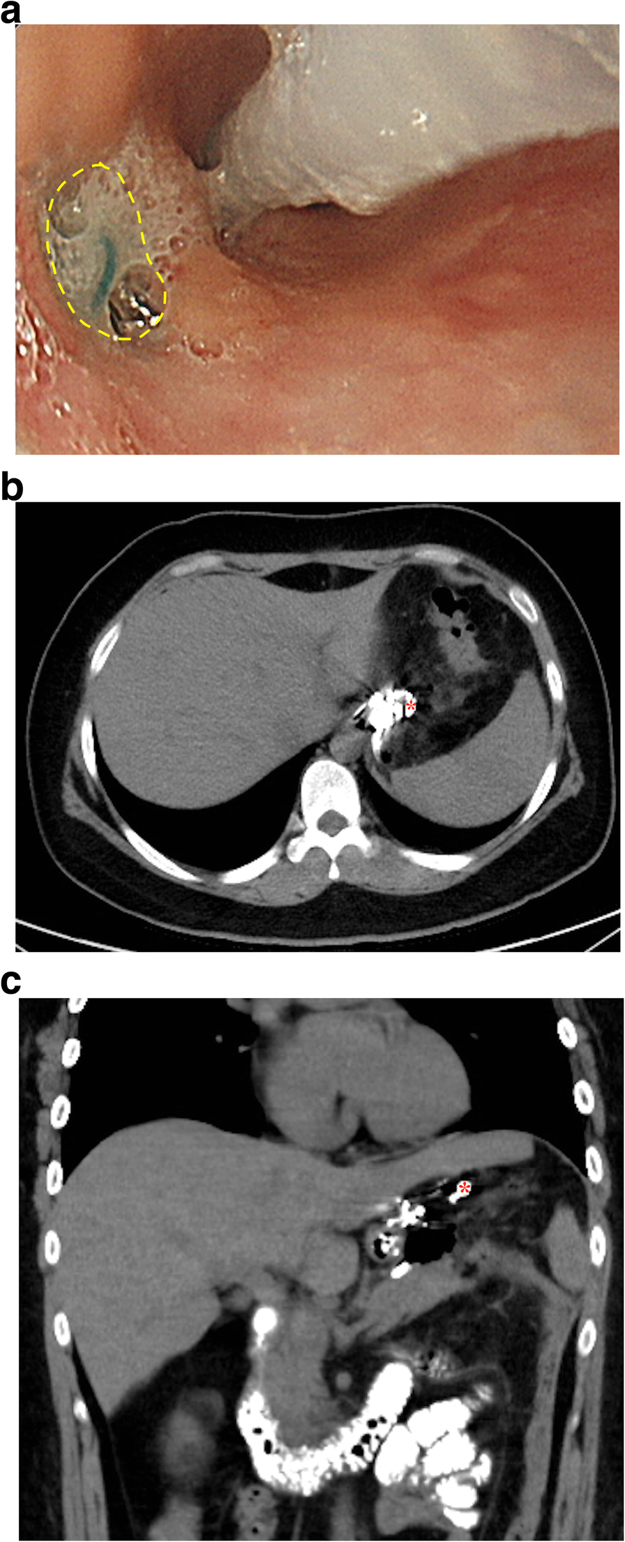 Fig. 2