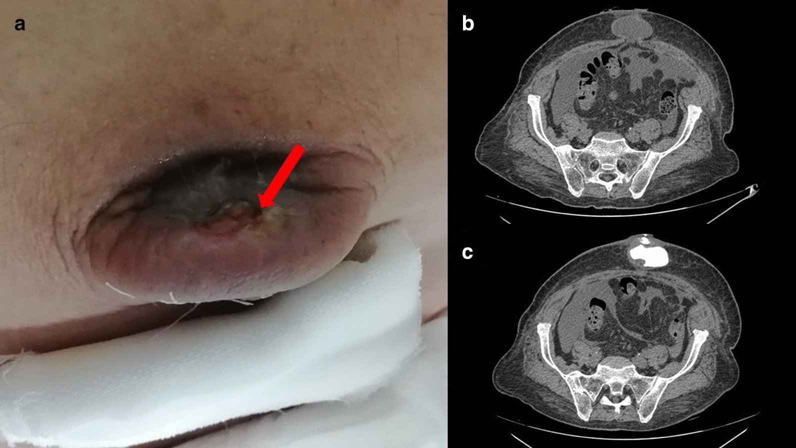 Fig. 2