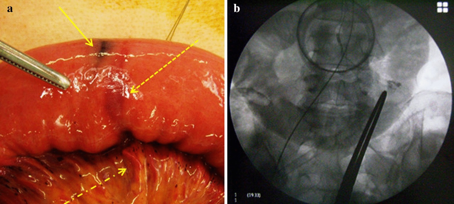 Fig. 2