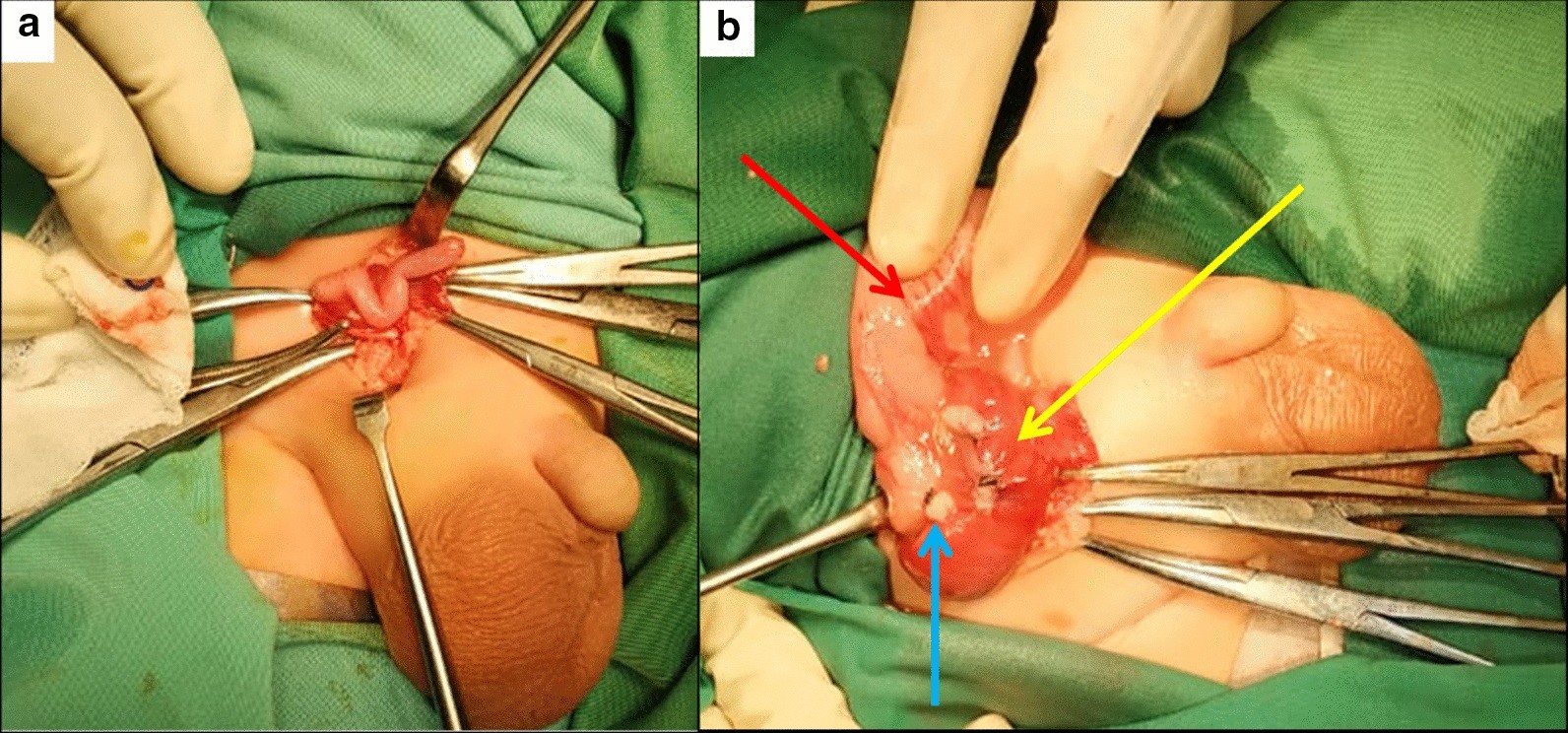 Fig. 3