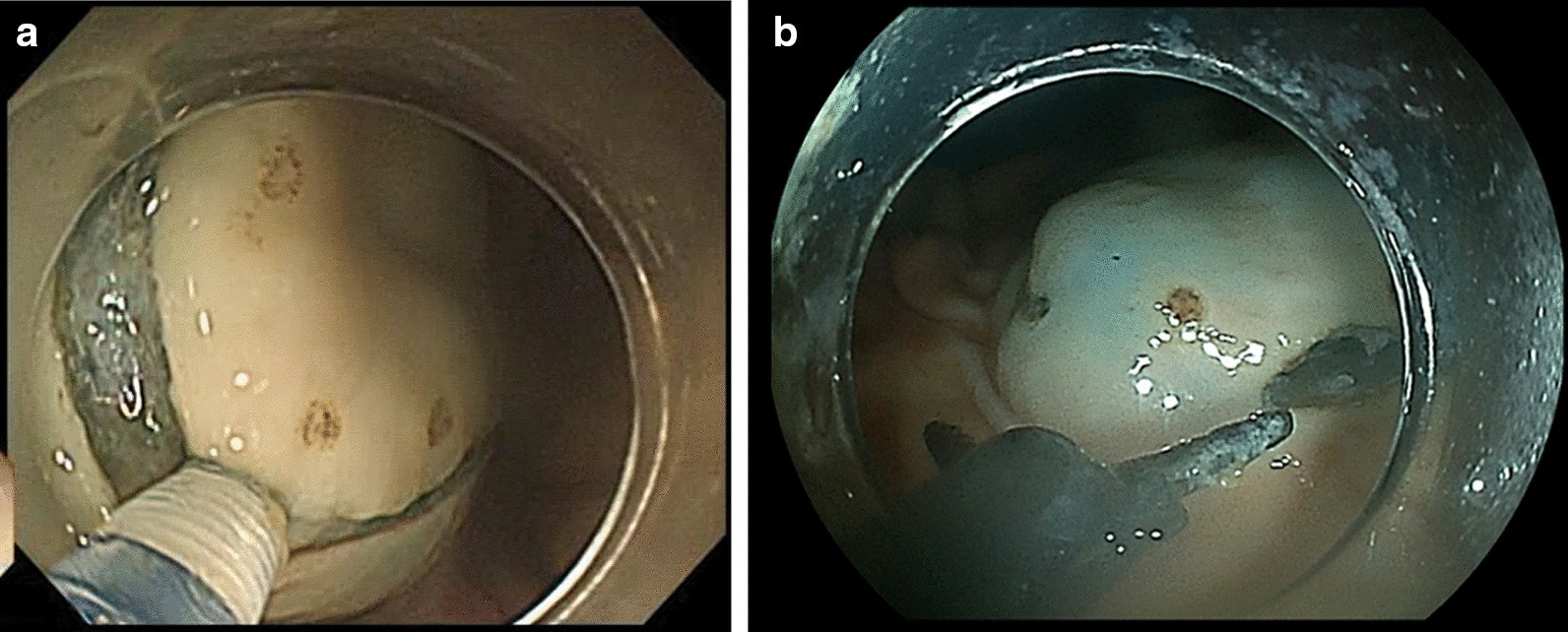 Fig. 4