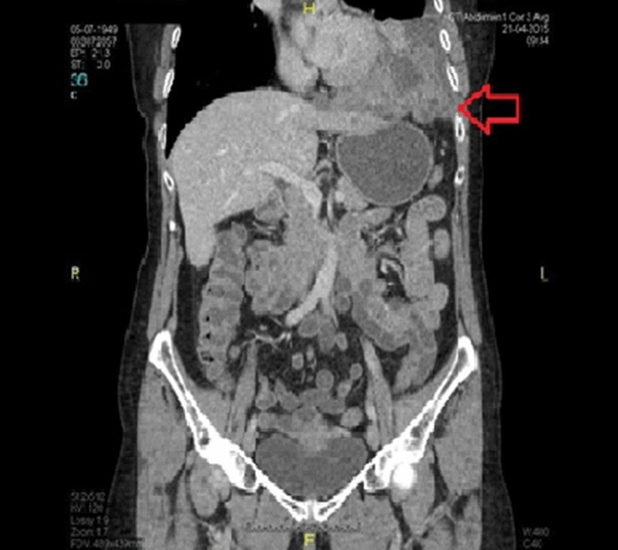 Fig. 1