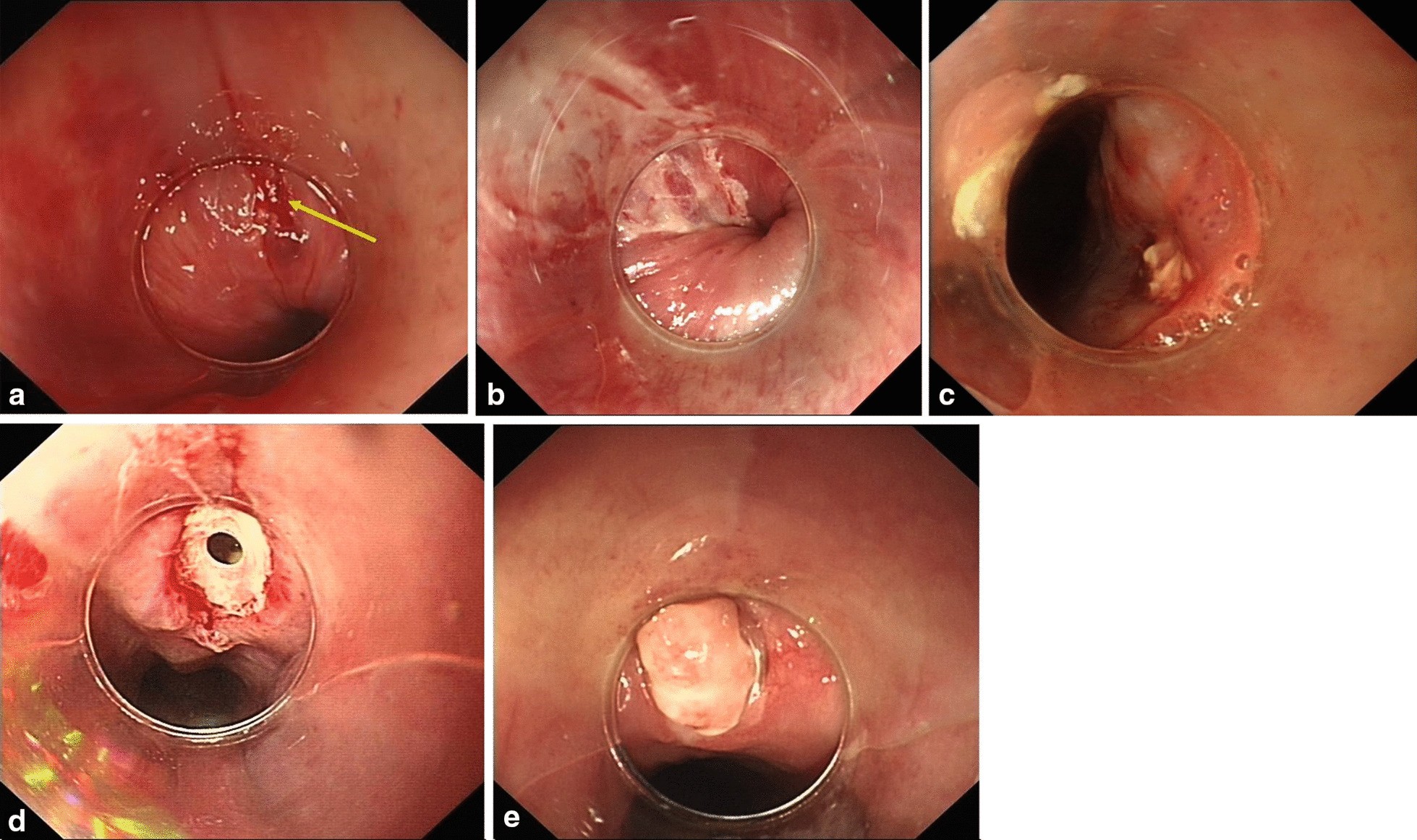 Fig. 3