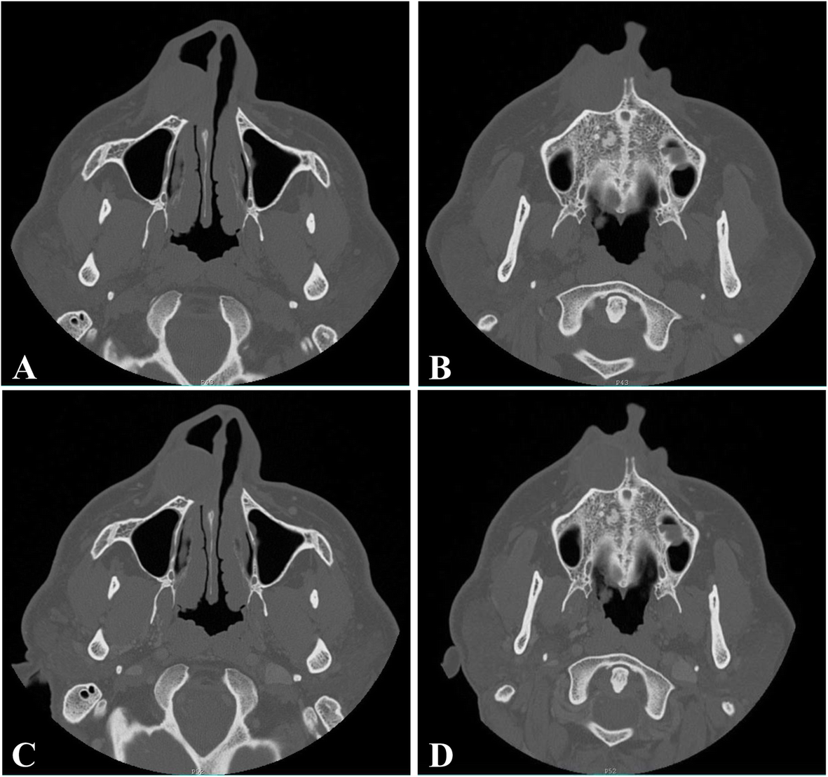 Fig. 3