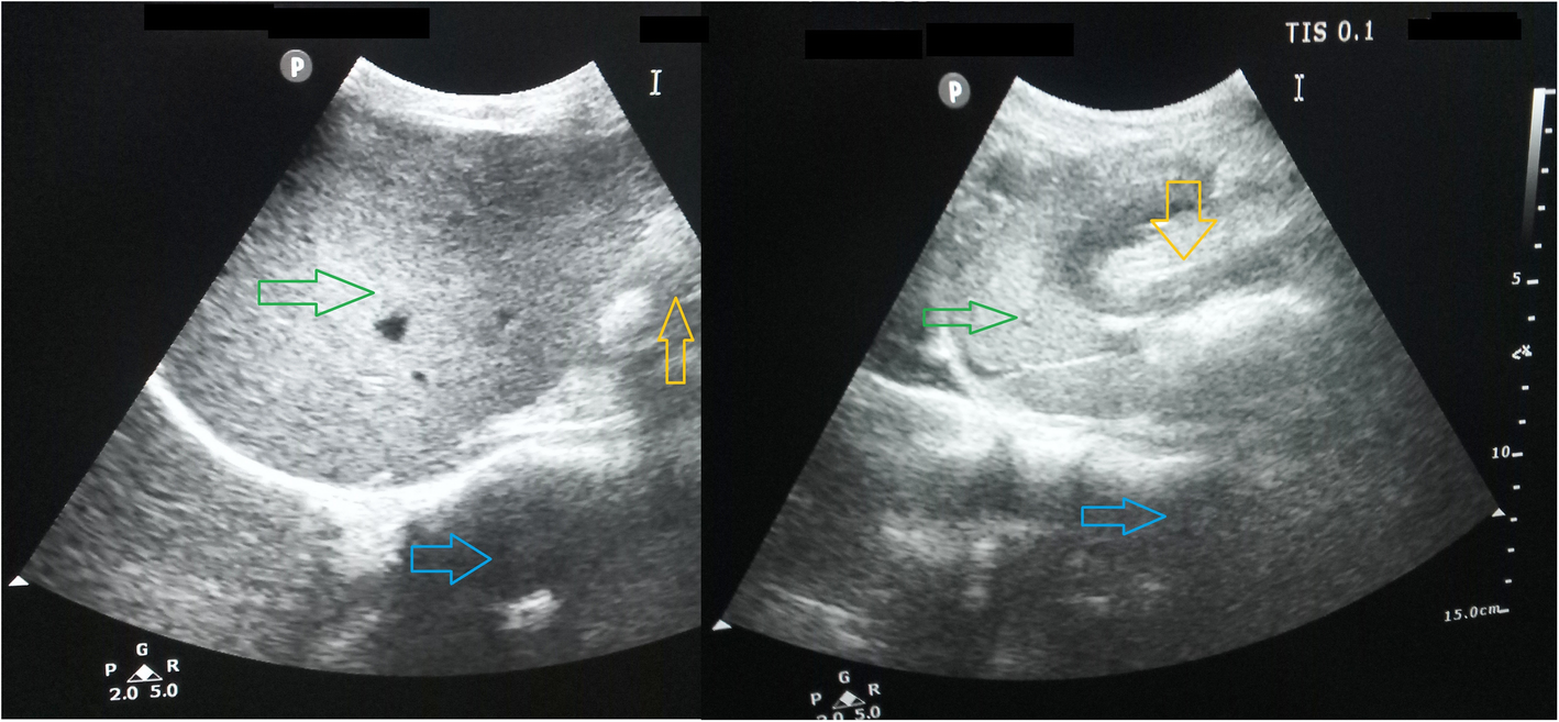 Fig. 5