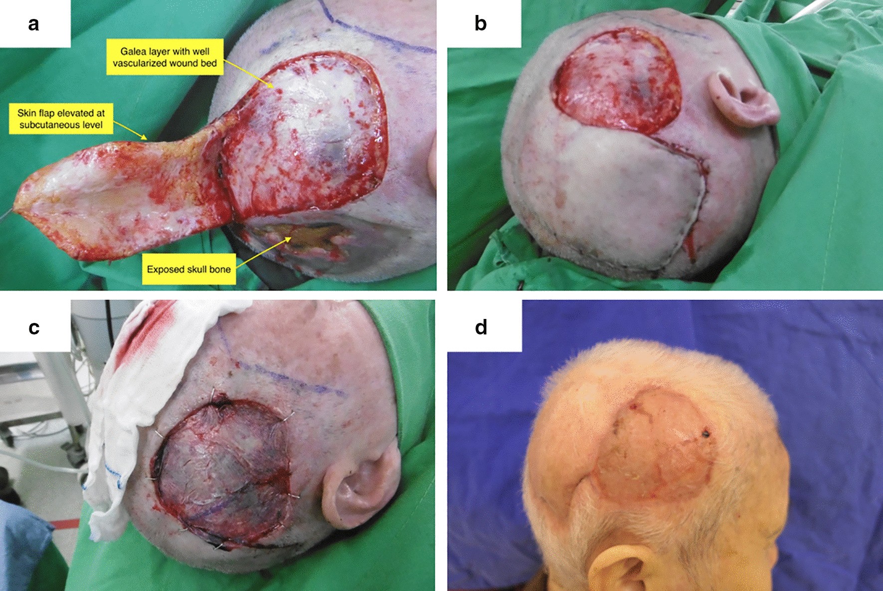 Fig. 2