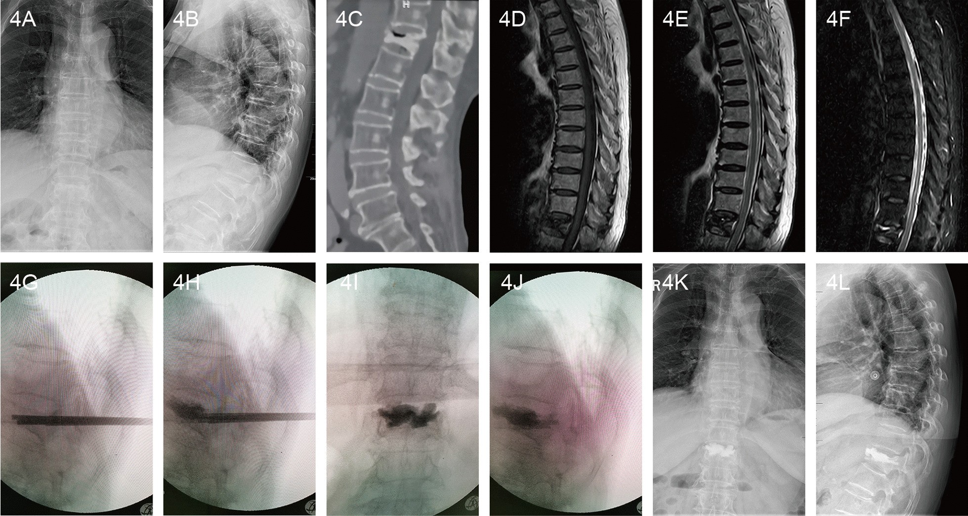 Fig. 4