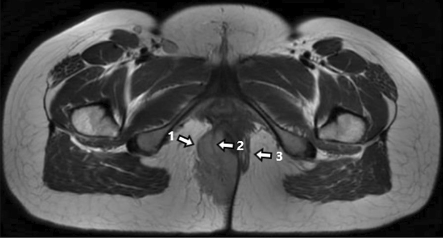 Fig.1