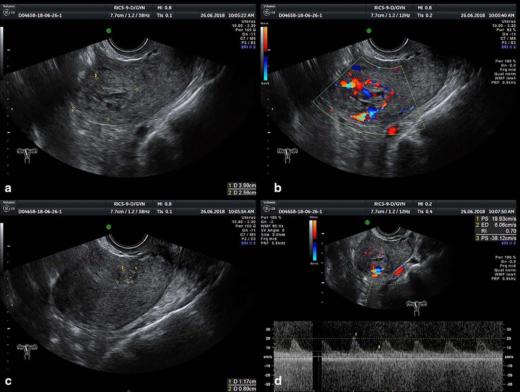 Fig. 3