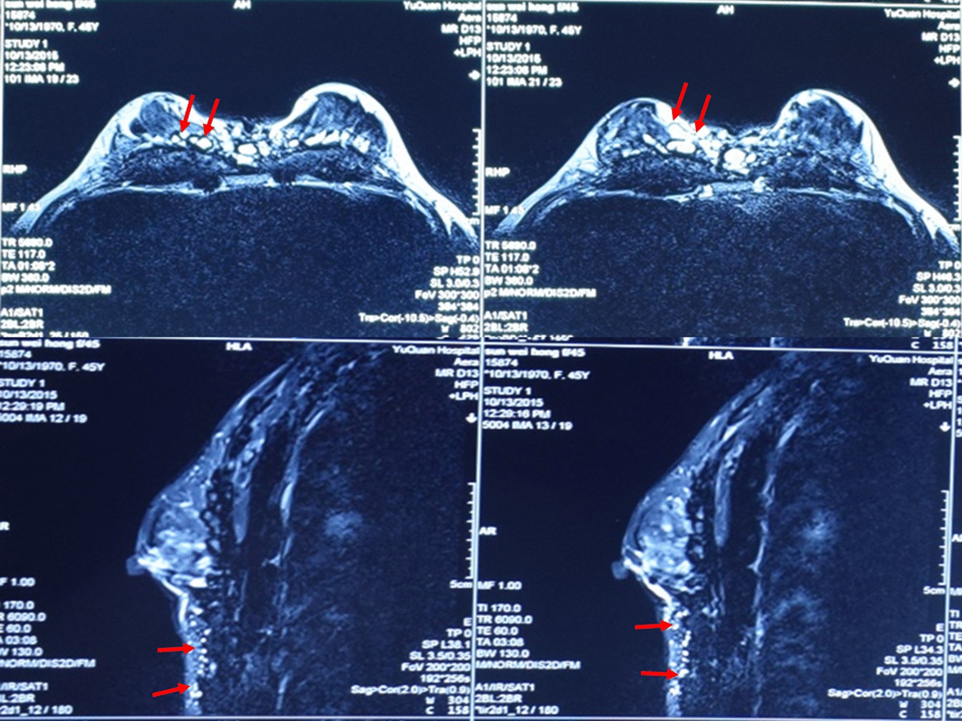 Fig.1