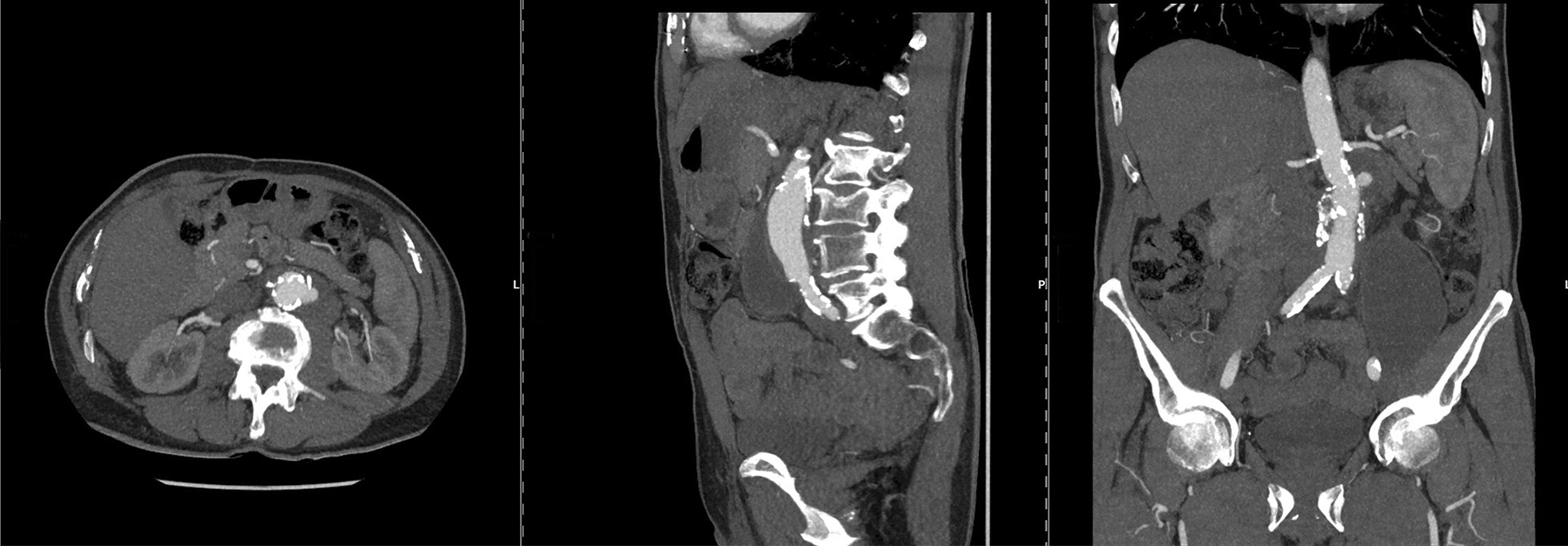 Fig. 3