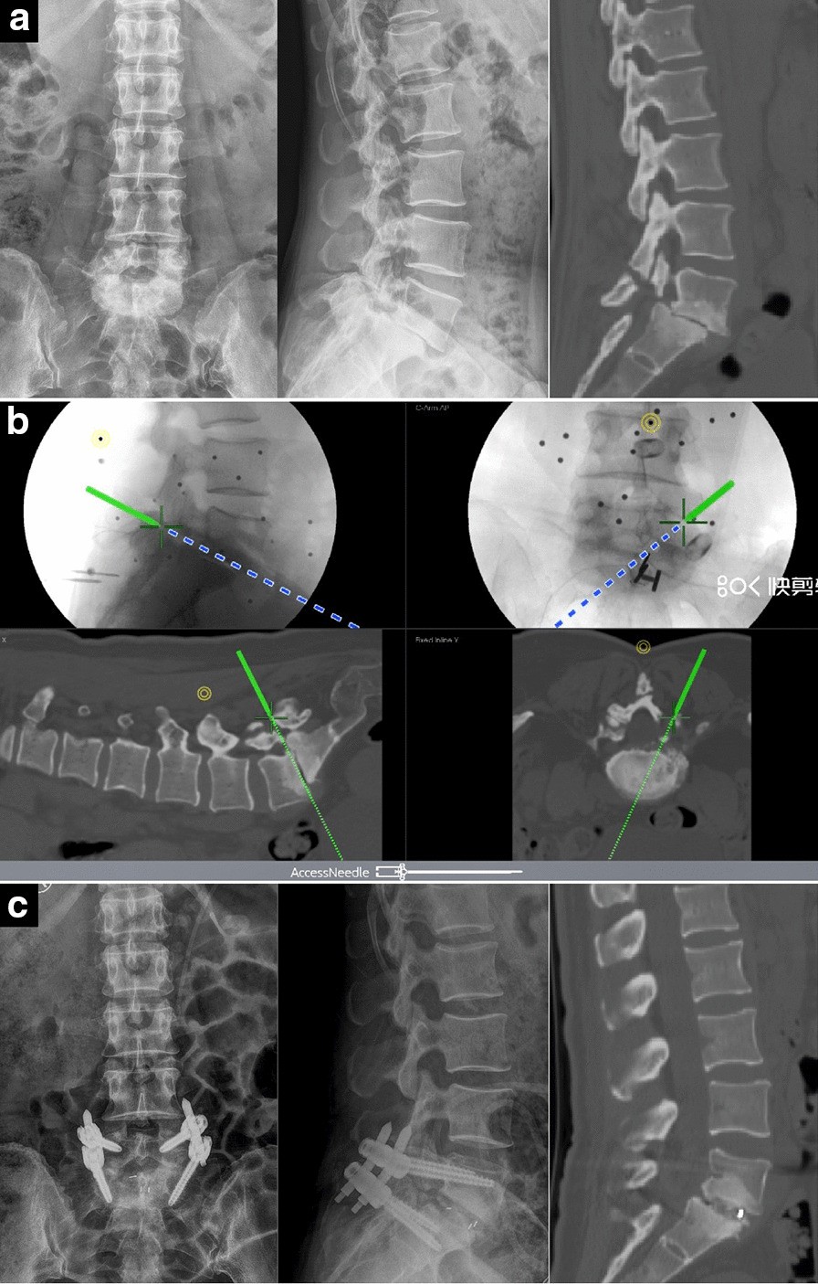 Fig. 4