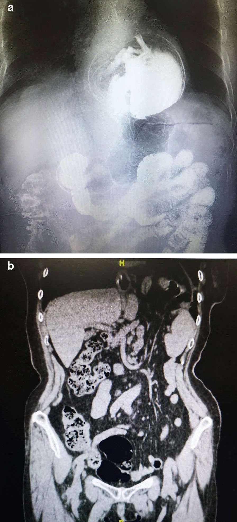 Fig. 3