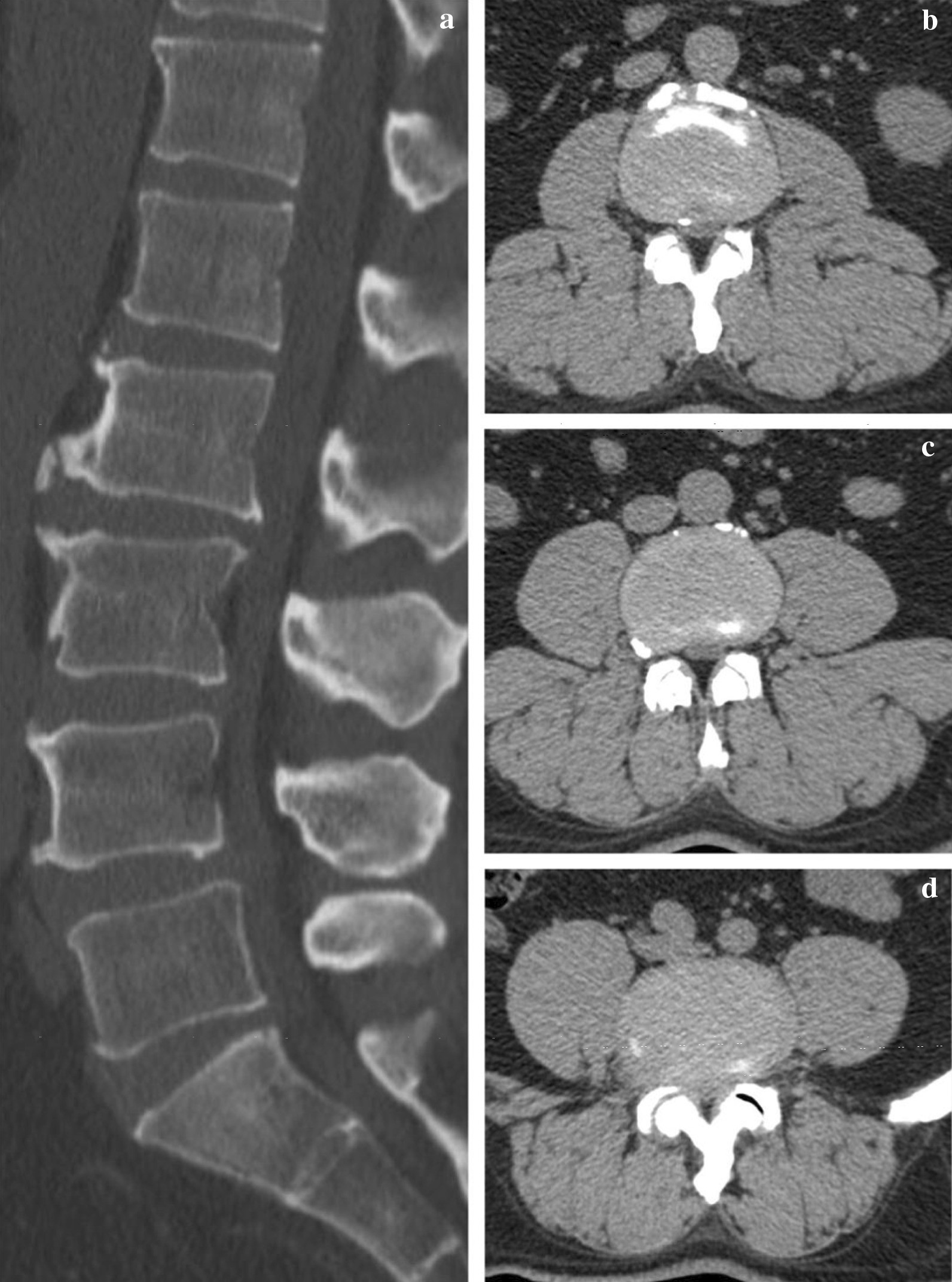 Fig. 1