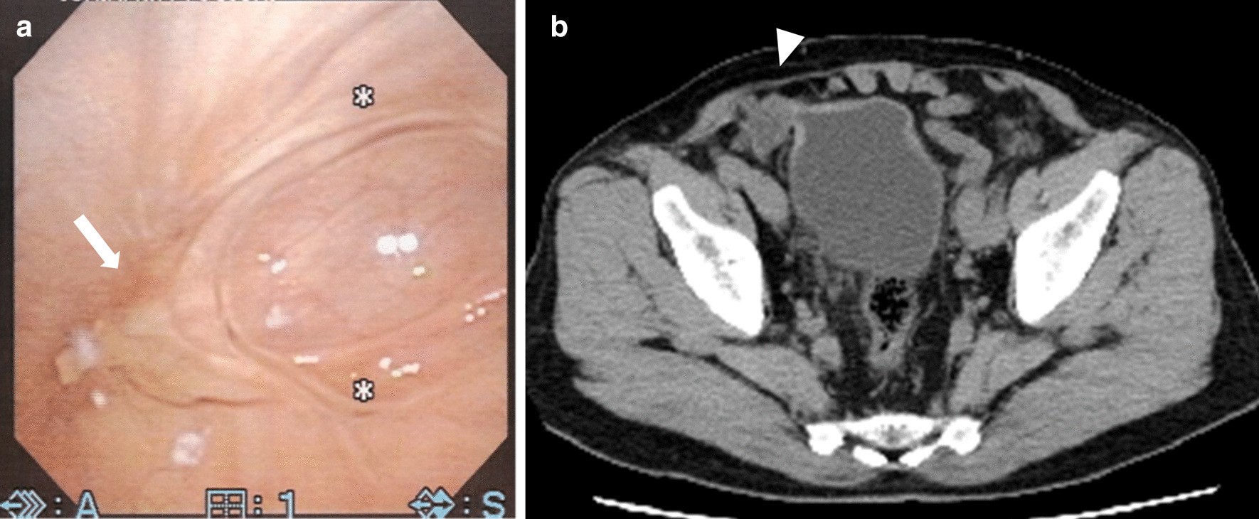 Fig. 4