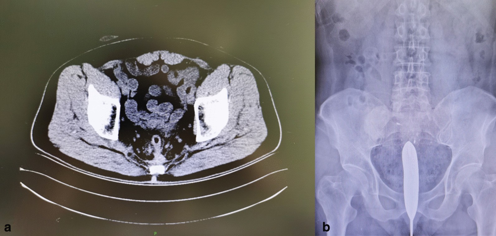 Fig. 1