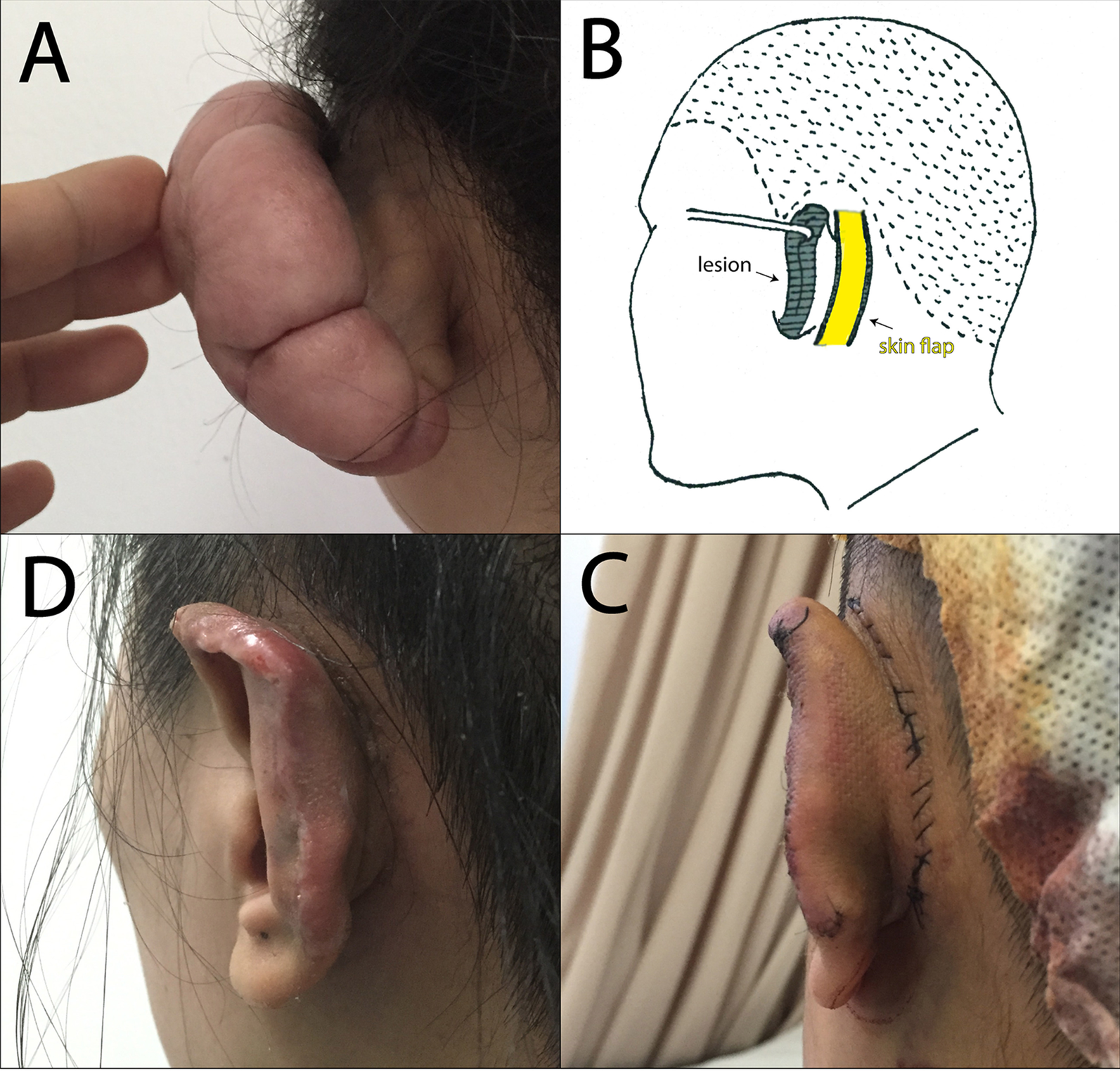 Fig. 3