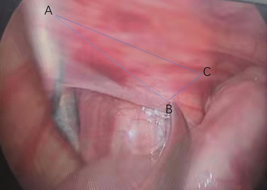 Fig. 10