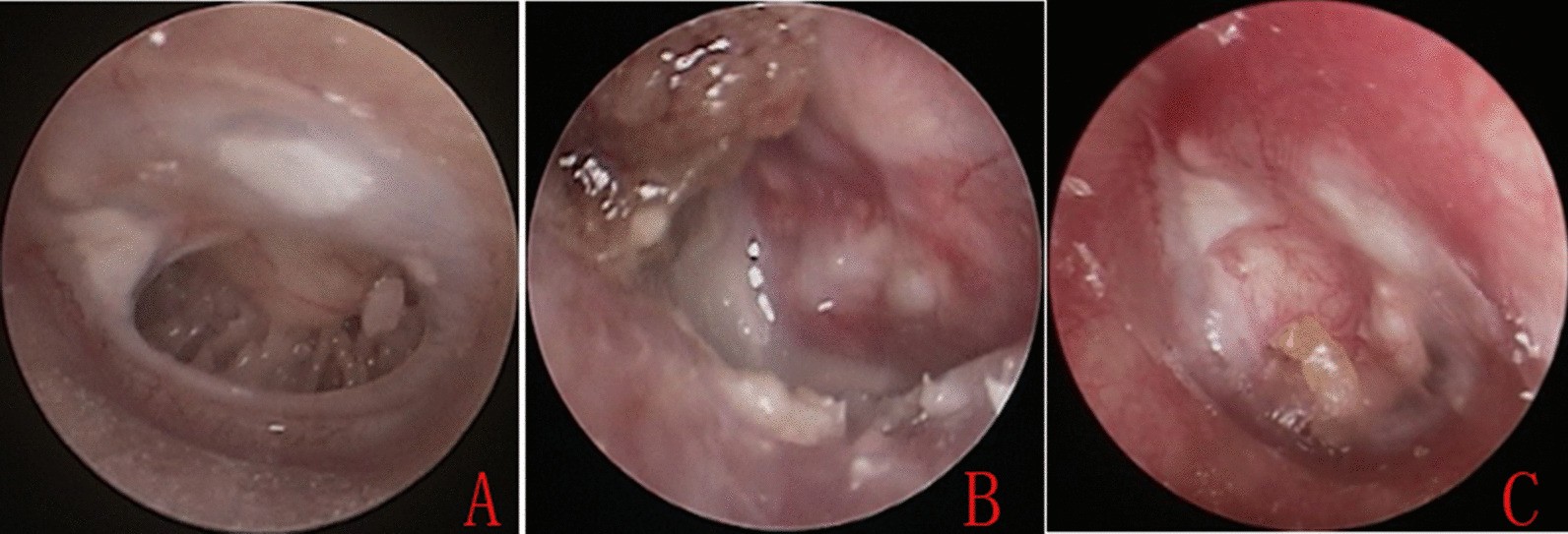 Fig. 3