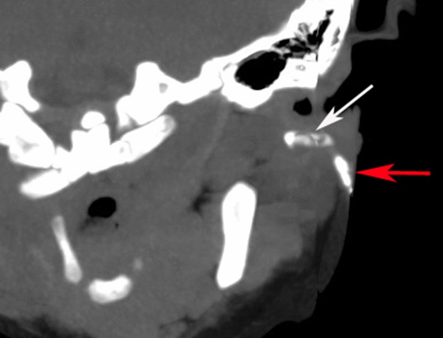 Fig. 2