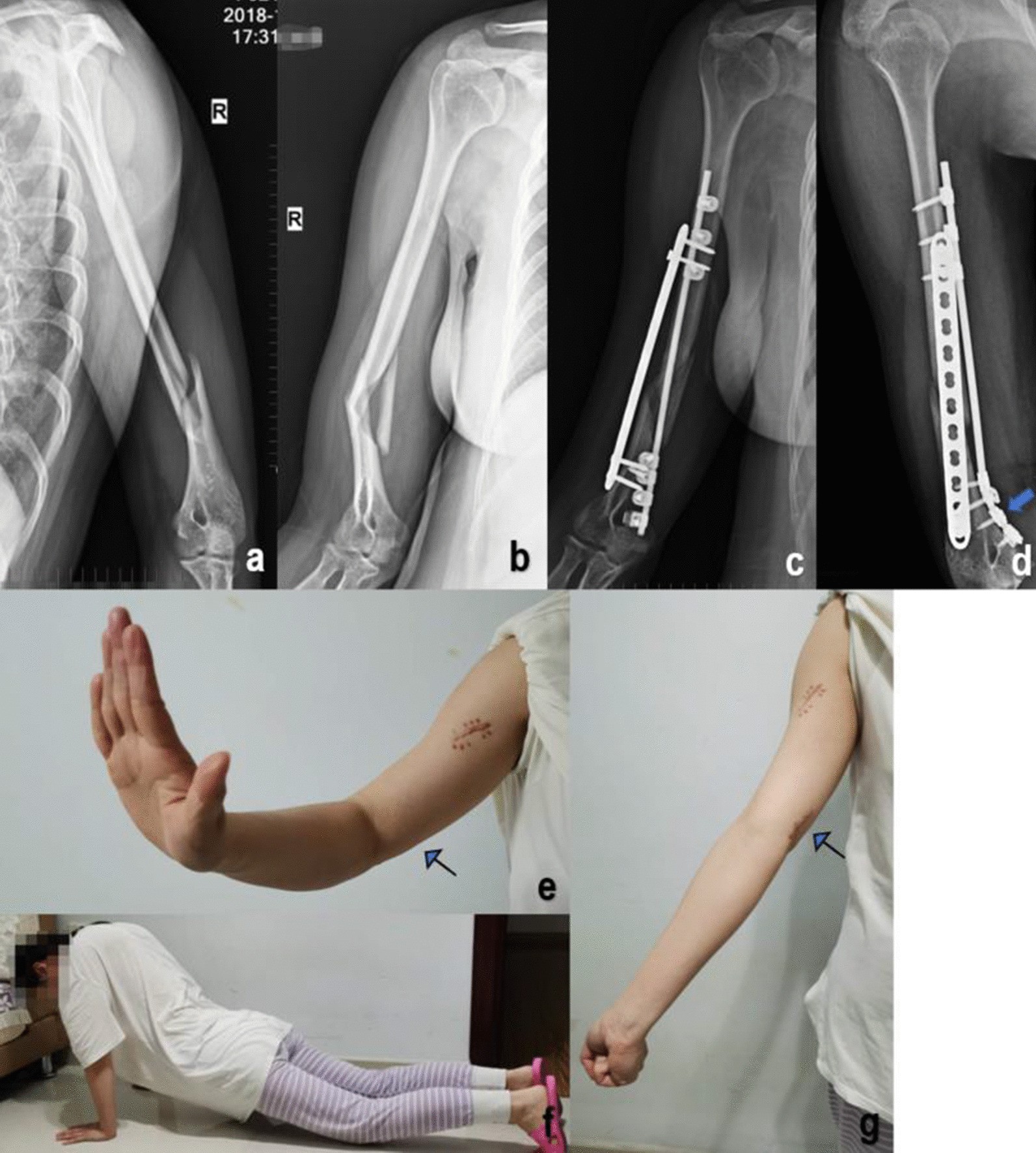 Fig. 3