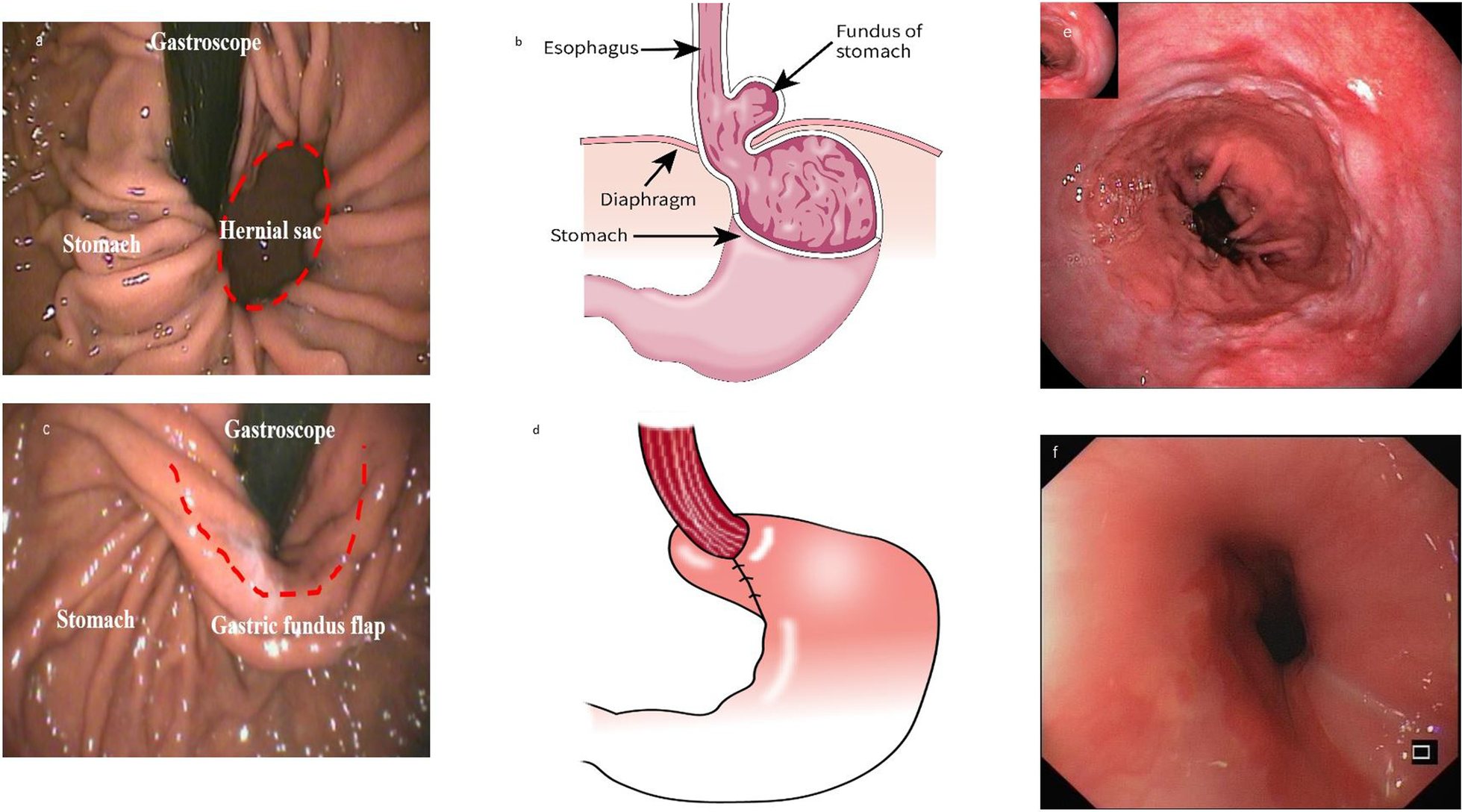 Fig. 6