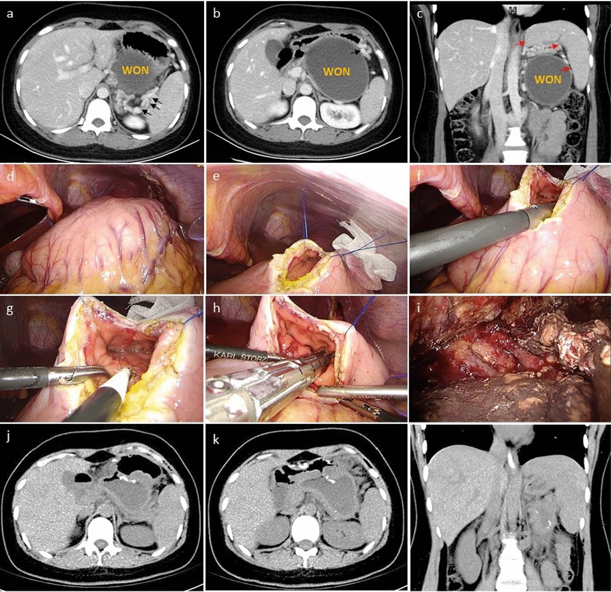 Fig. 2