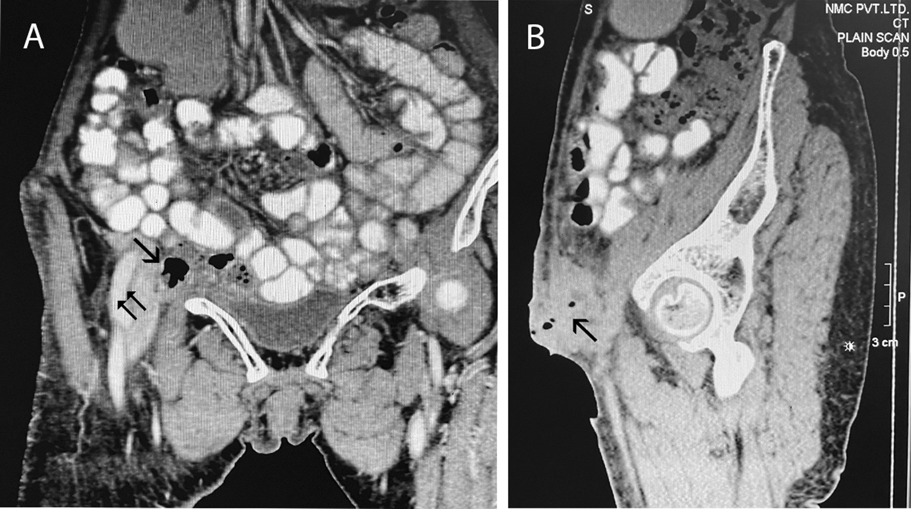 Fig. 2