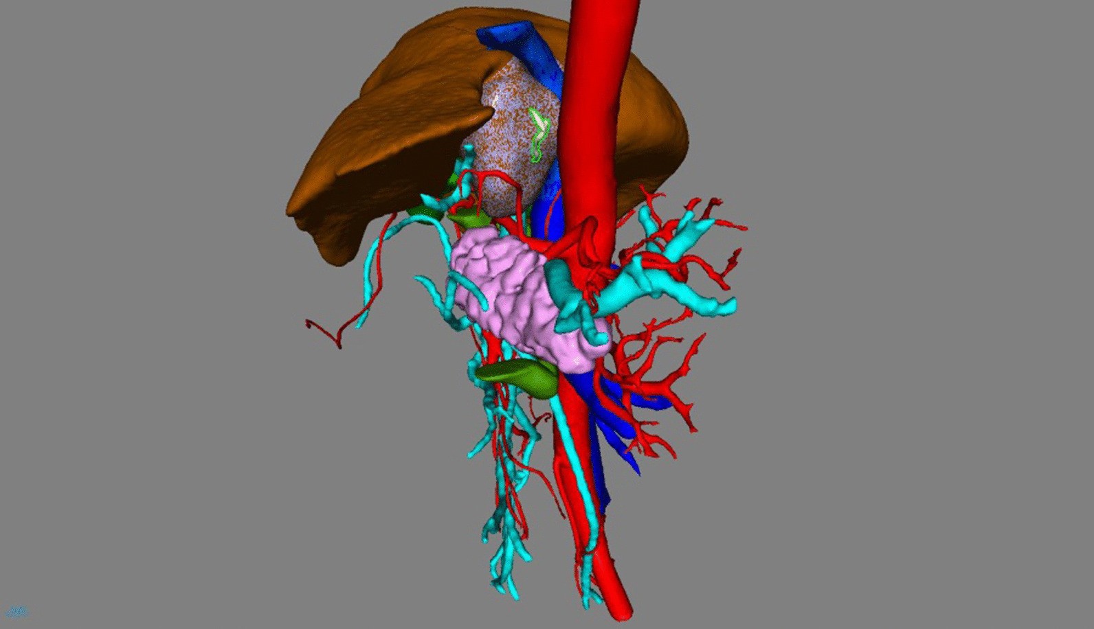 Fig. 4