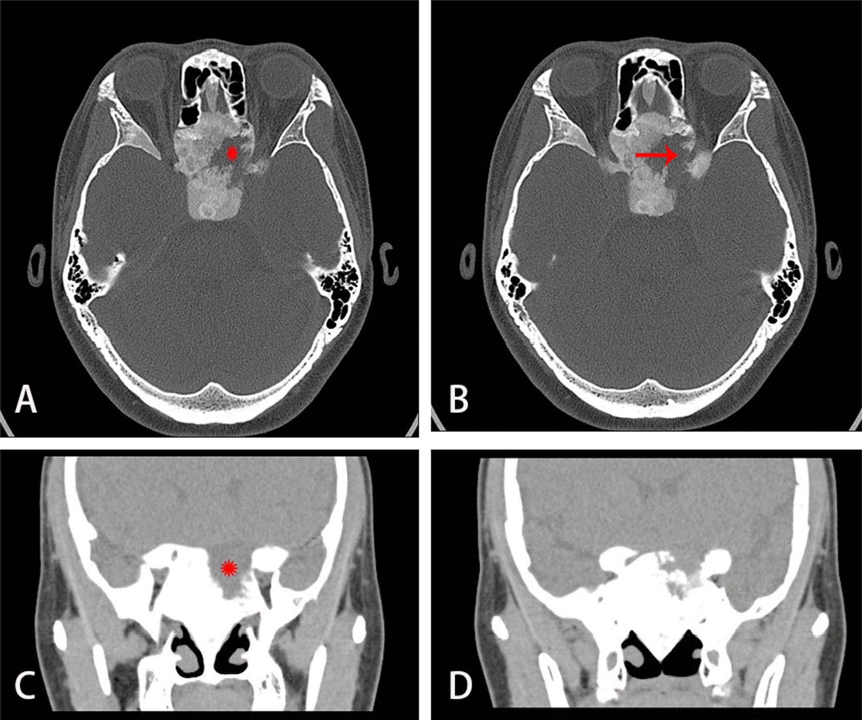 Fig. 5