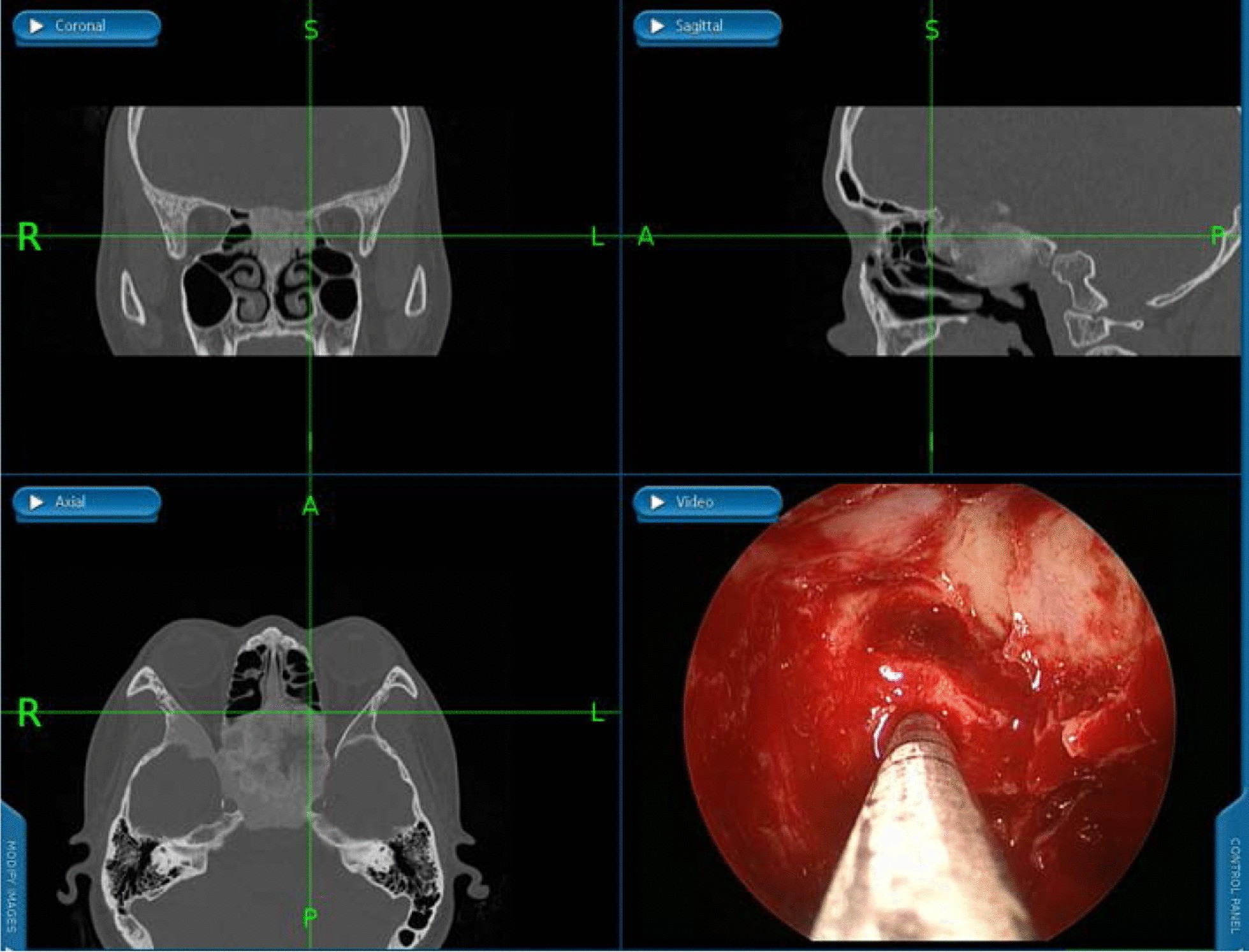 Fig. 7