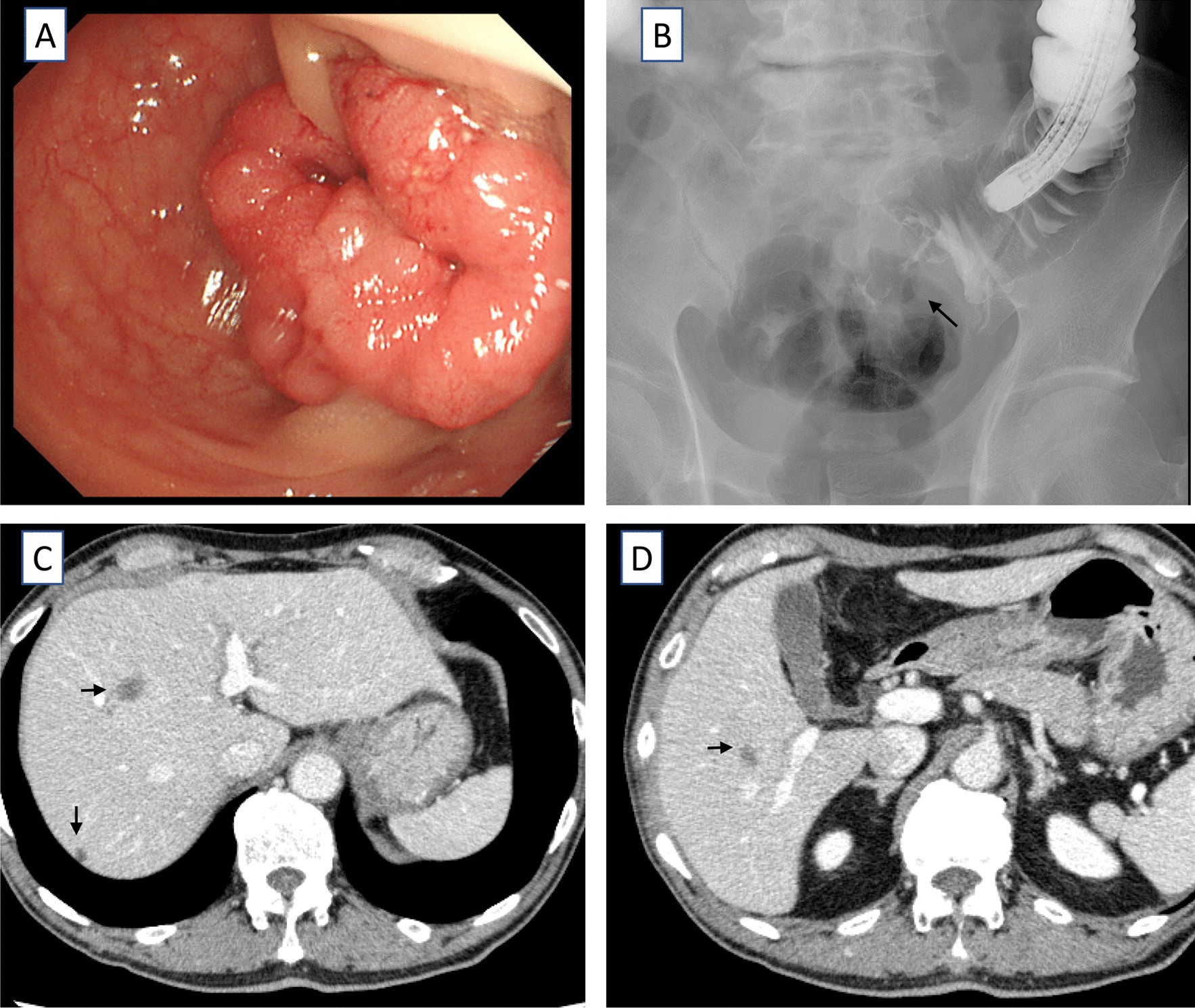 Fig. 1