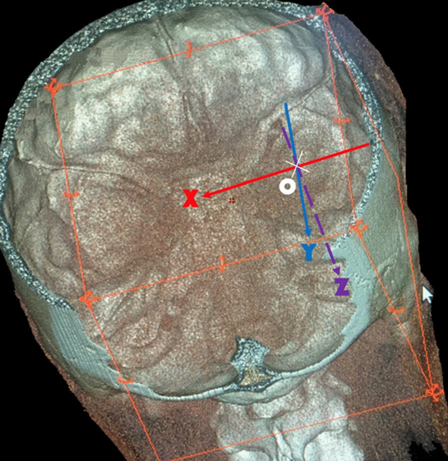 Fig. 1