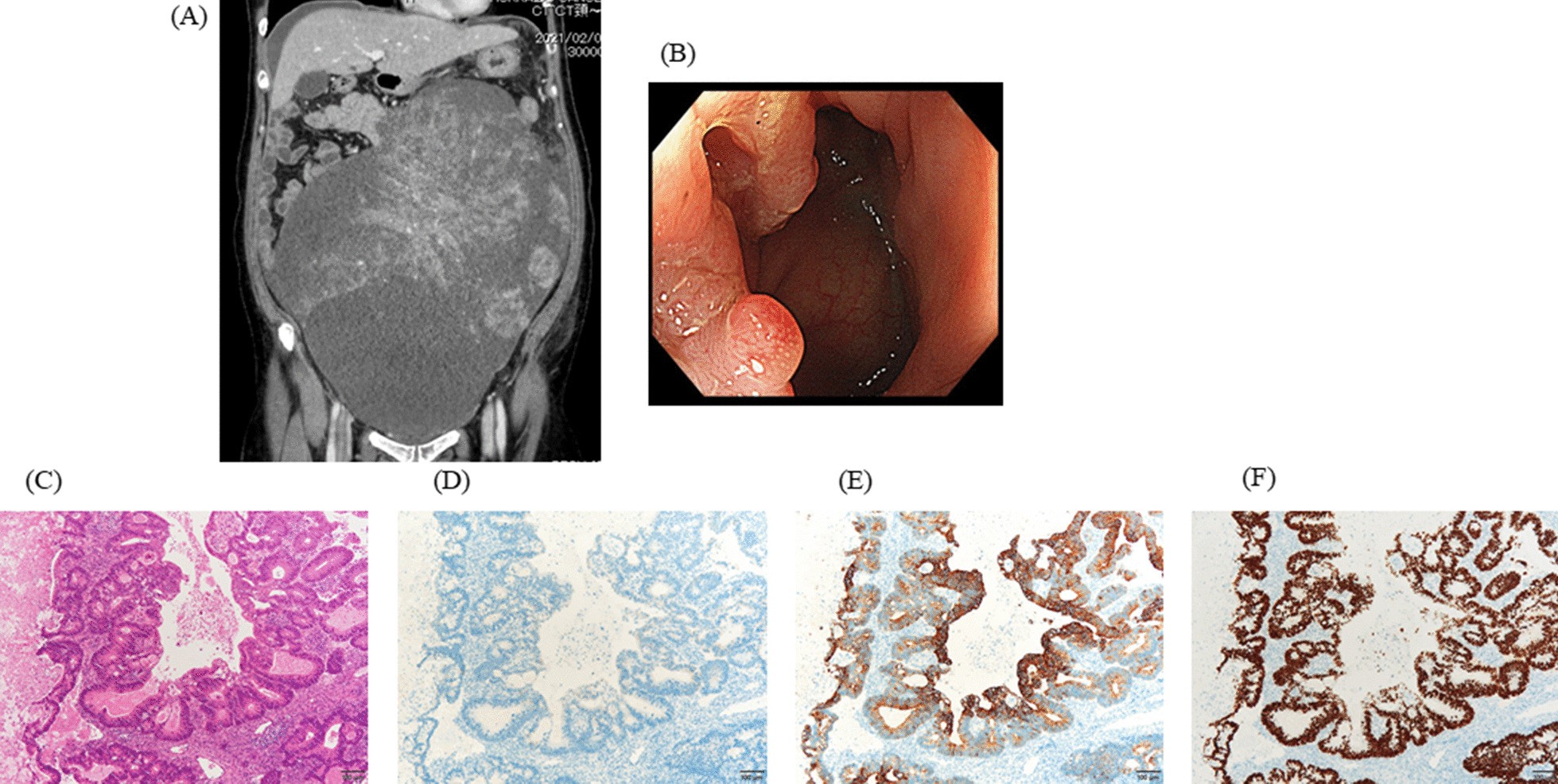 Fig. 2